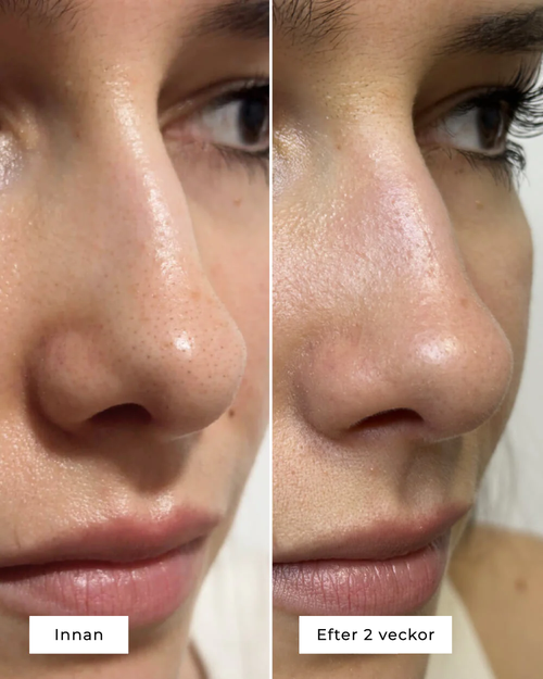 CLEAR PORE DUO